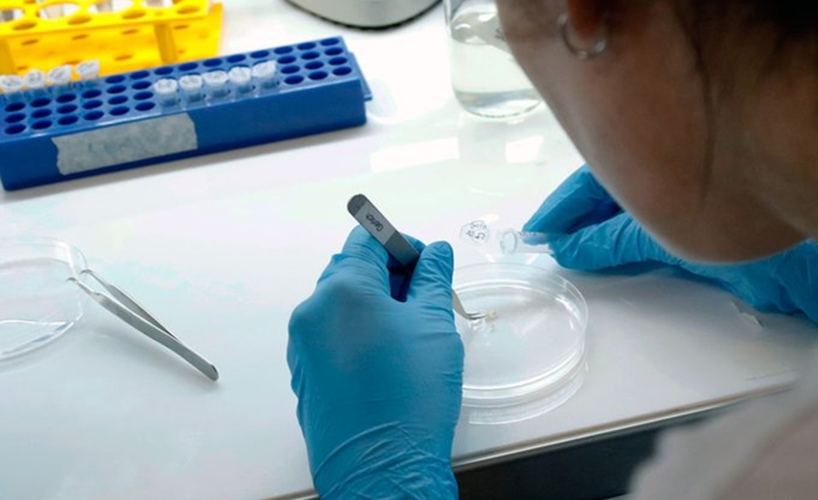 Cifra de contagios por COVID-19 en Colombia ascendió a 84.442