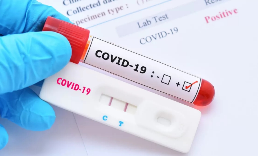La importancia de las pruebas rápidas para combatir el COVID-19
