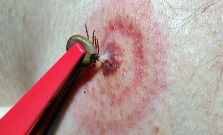 Detectan bacteria no reportada en el Atlántico