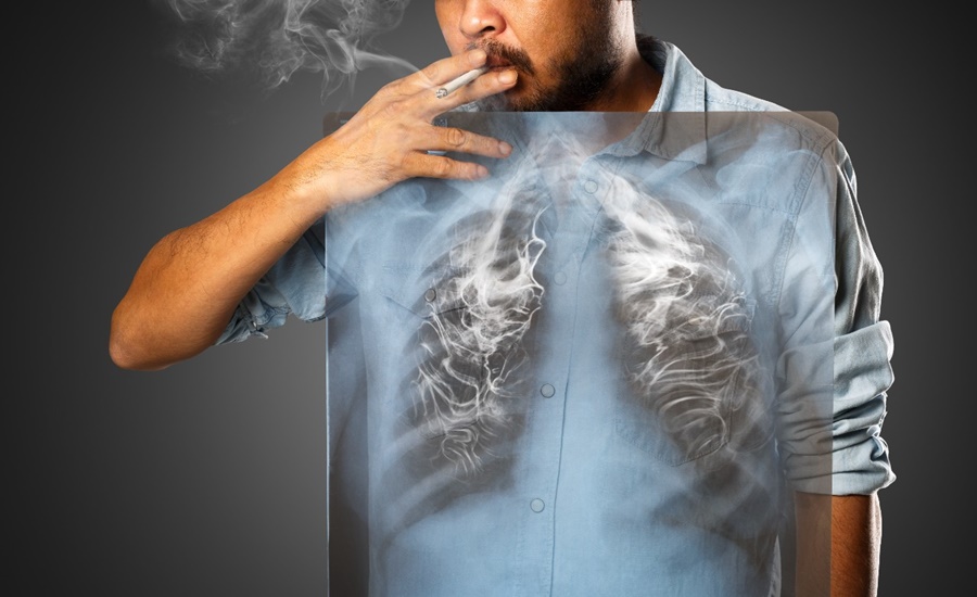 En el Día Mundial sin Tabaco, conozca los impactos negativos que genera en su salud