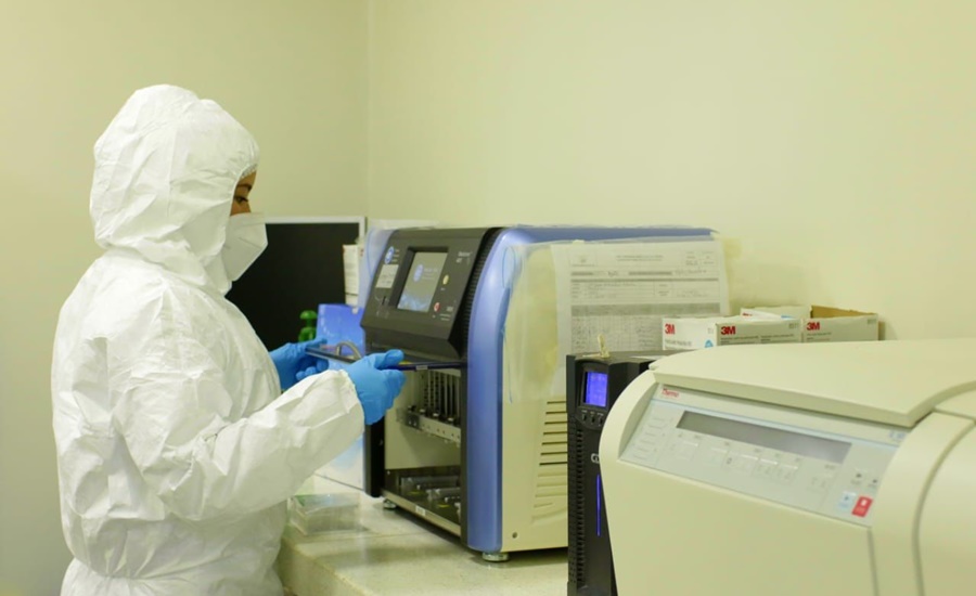 Laboratorio de Salud Pública del Atlántico realiza muestras de detección temprana de casos de viruela símica