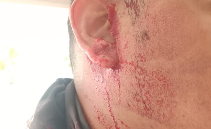 Con cacha de arma de fuego hieren en la cabeza a operario de Air-e en el norte de Barranquilla